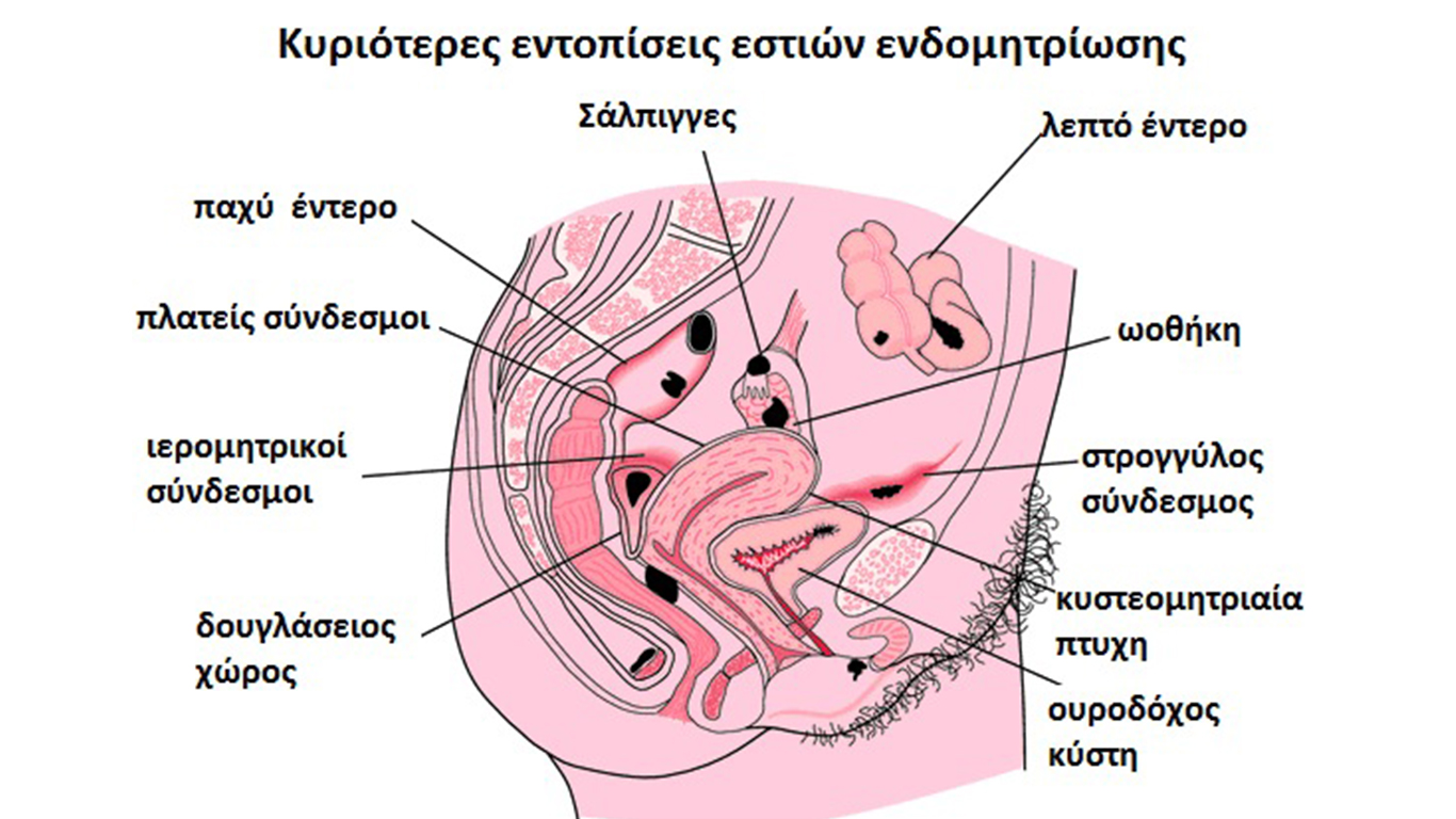 Definition Of Carina Vaginae By Medical Dictionary